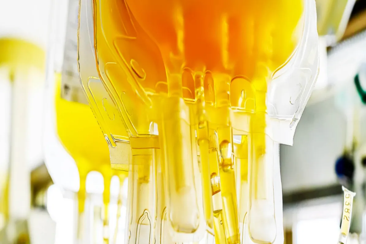 Close-up view of filled plasma bags in a clinical setting