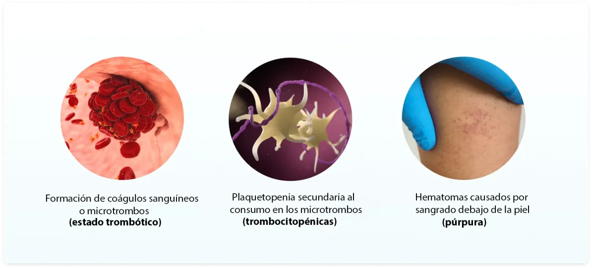 Row of three circular images and text. One image is of red blood cells, the next, platelets, the third is bruised skin